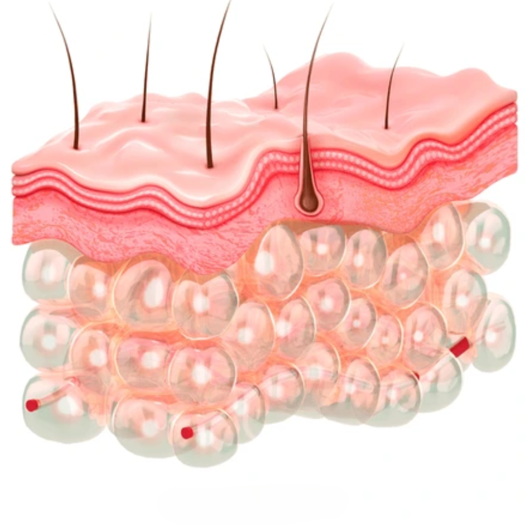 Cellulisi - spray anticellulite (3)
