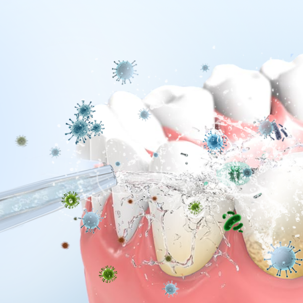 Idropulsore dentale (4)